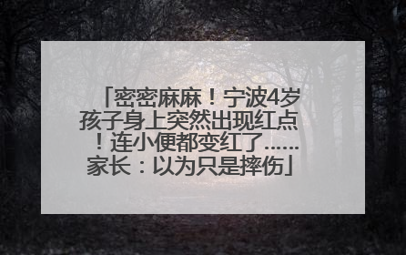 密密麻麻！宁波4岁孩子身上突然出现红点！连小便都变红了……家长：以为只是摔伤